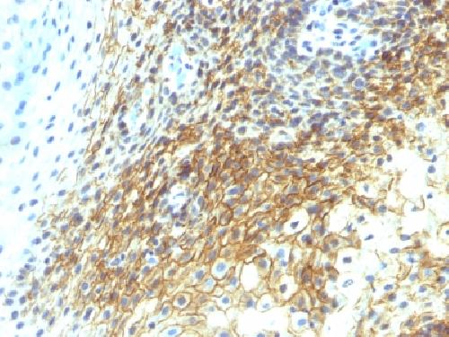 CD44v4 (Marker of Tumor Metastasis) Antibody