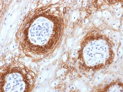 CD44v6 (Marker of Tumor Metastasis) Antibody