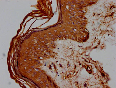 CD44 Monoclonal Antibody