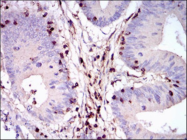 PTPRC Antibody