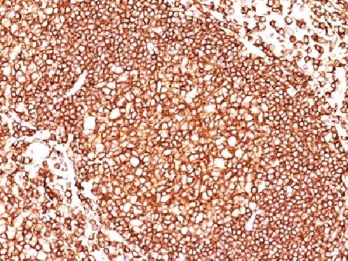 CD45 / LCA (Leucocyte Marker) Antibody