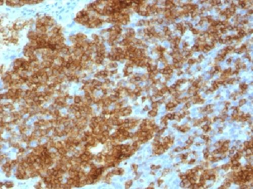 PTPRC Antibody