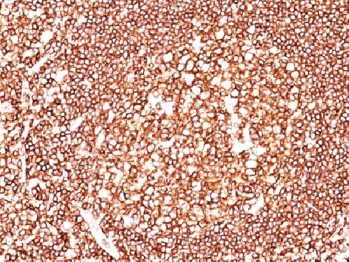 CD45 / LCA (B-Cell Marker) Antibody