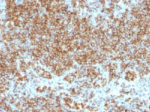 CD45 / LCA (Leucocyte Marker) Antibody