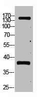 PTPRC Antibody