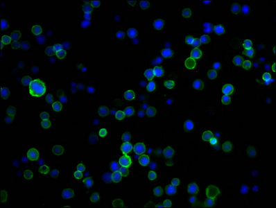 CD45 Monoclonal Antibody