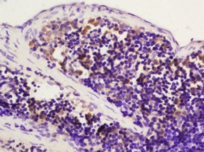 CD45 Rabbit Polyclonal Antibody