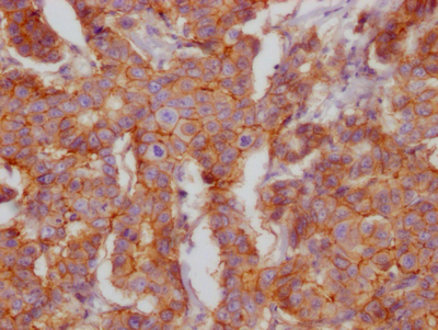 CD46 Recombinant Monoclonal Antibody
