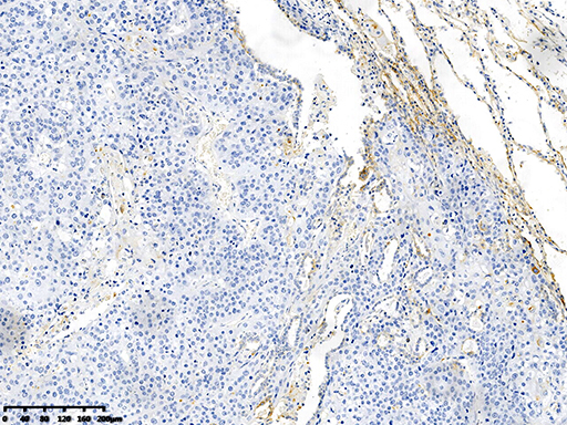 CD47 Antibody
