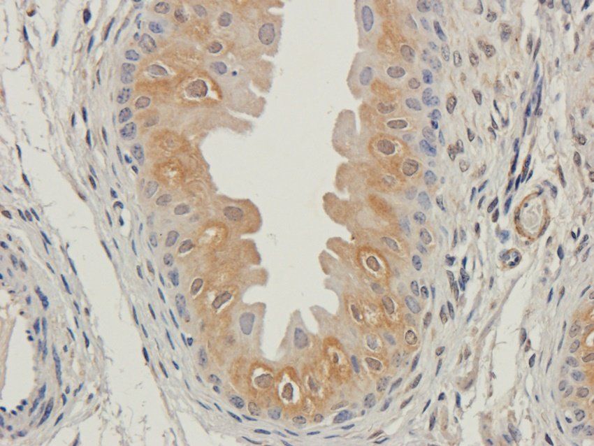 CD47 antibody