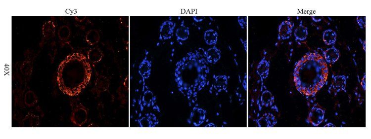 CD4 antibody