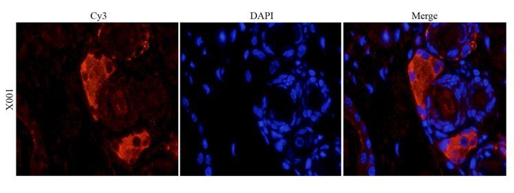 CD4 antibody