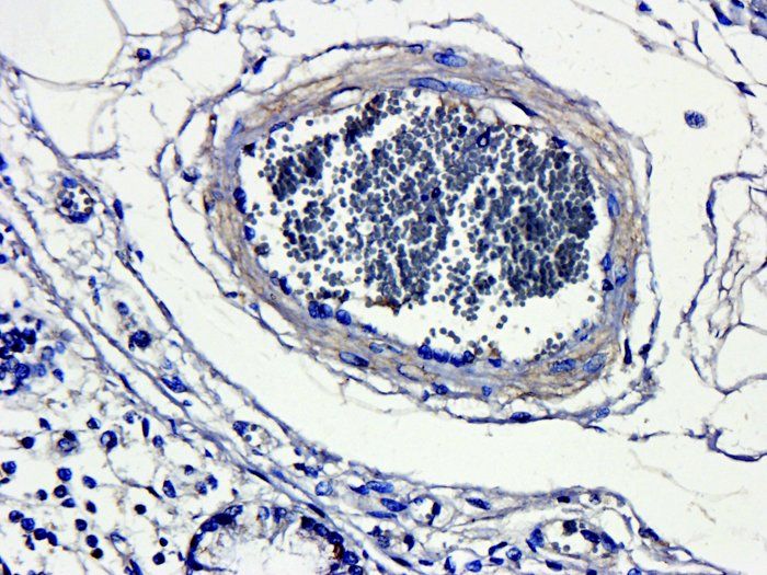 CD4 antibody