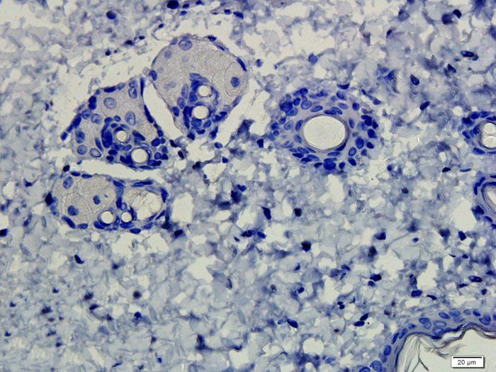 CD4 antibody
