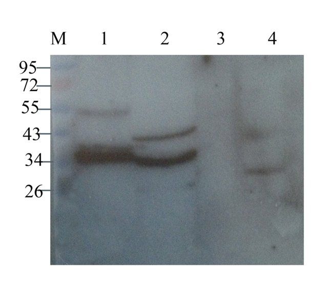 CD4 antibody