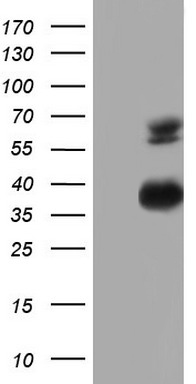 CD5 Antibody
