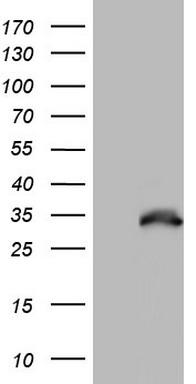 CD5 Antibody