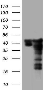 CD5 Antibody