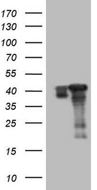CD5 Antibody