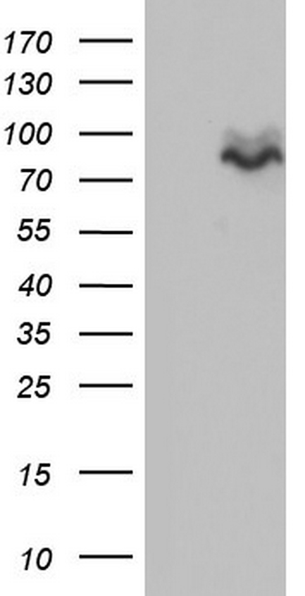 CD5 Antibody