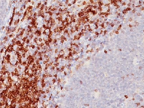 CD5 Antibody