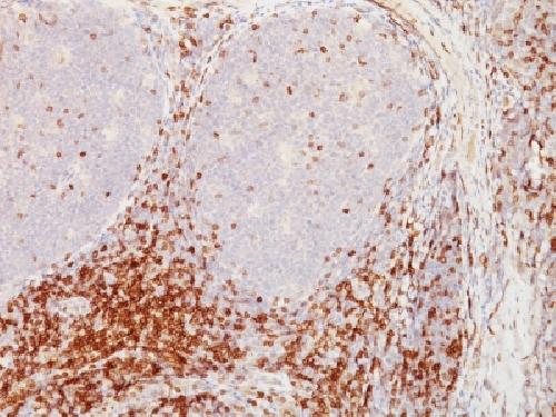 CD5 Antibody