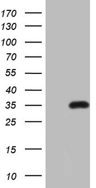 NCAM1 (CD56) Antibody