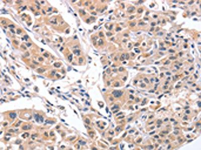 CD5L Antibody
