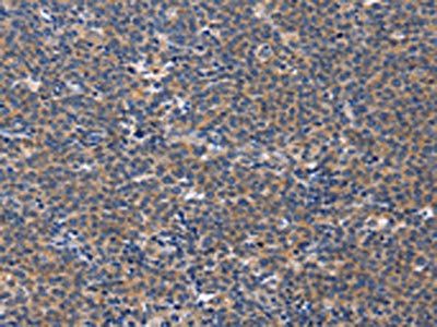 CD5L Antibody