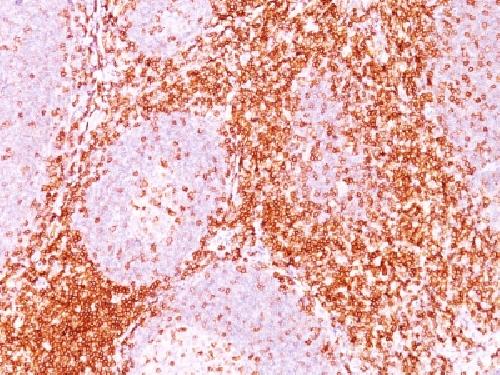 CD6 Antibody