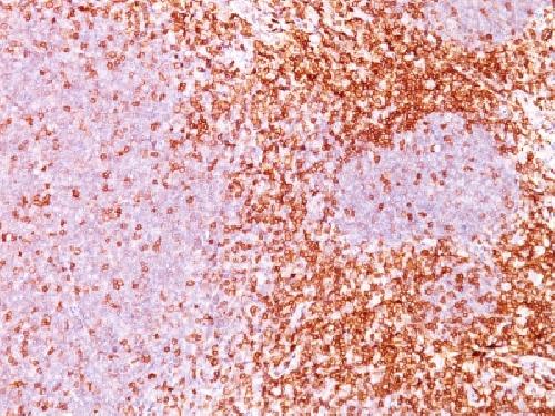 CD6 Antibody