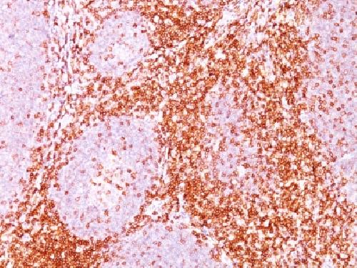 CD6 Antibody