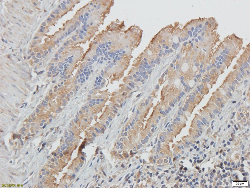 CD62E antibody