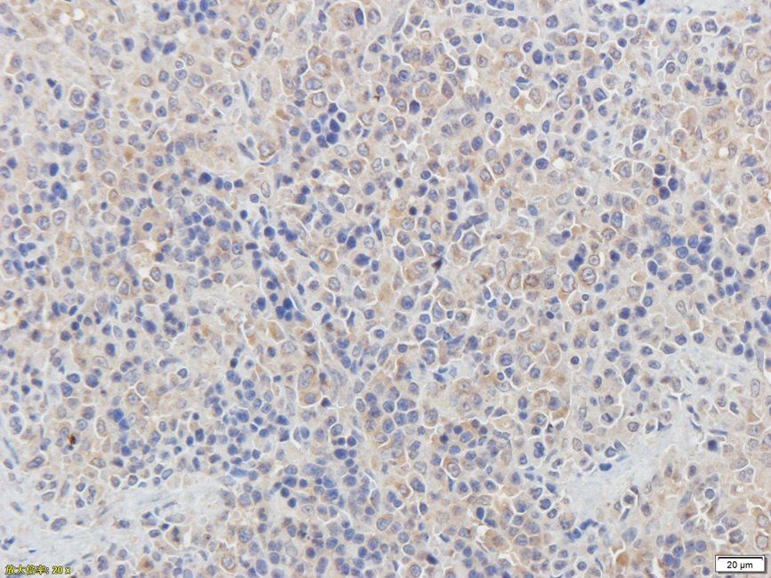 CD62E antibody