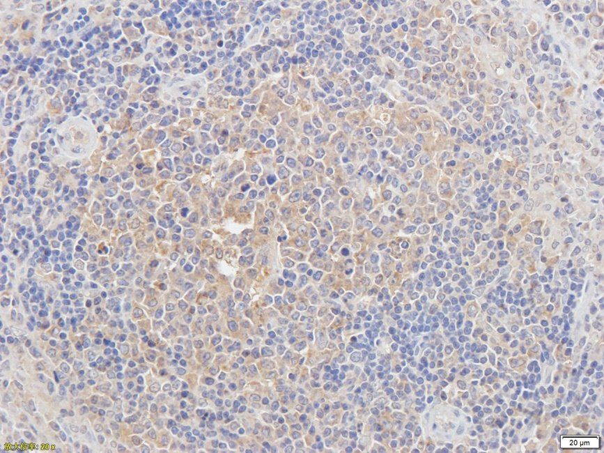 CD62E antibody