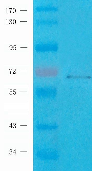 CD62E antibody