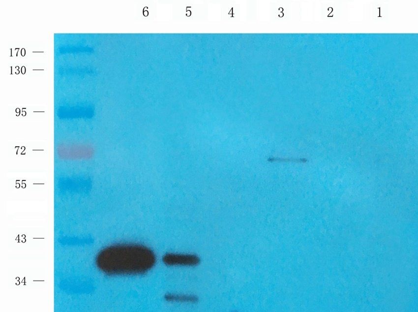 CD62E antibody