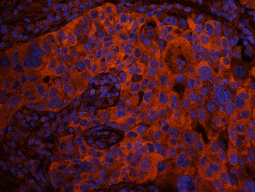 CD62P antibody