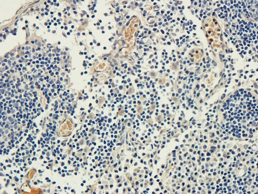 CD62P antibody