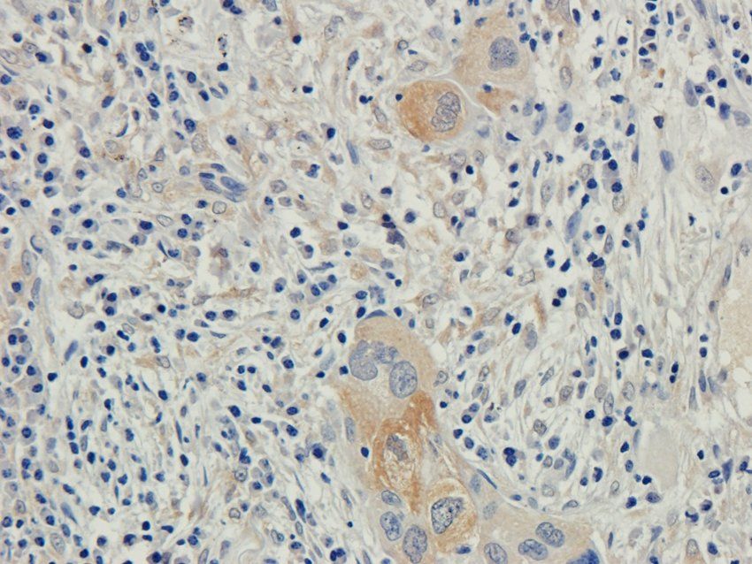 CD62P antibody