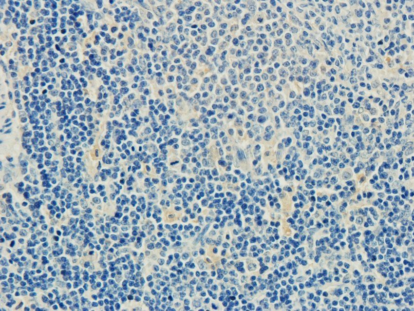 CD62P antibody