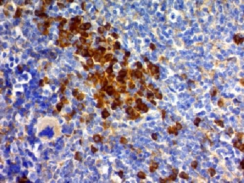 CD63 (Late Endosomes Marker) Antibody