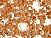 CD63 (Late Endosomes Marker) Antibody