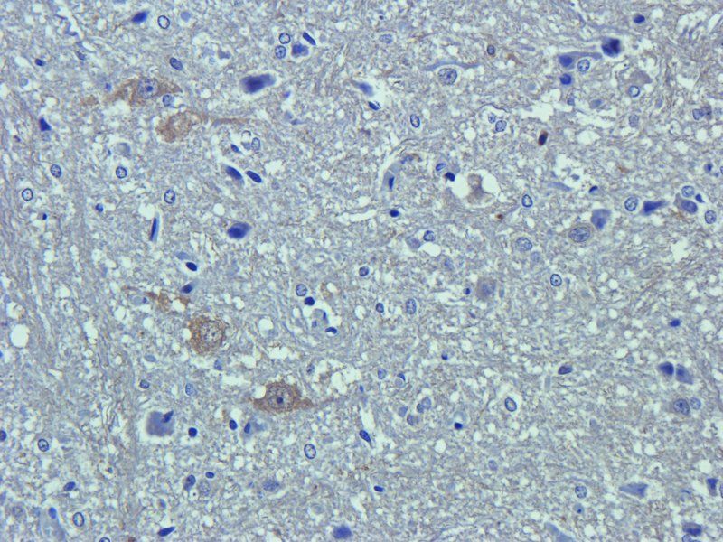 CD63 antibody