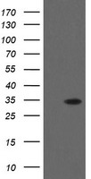 FCGR1A Antibody
