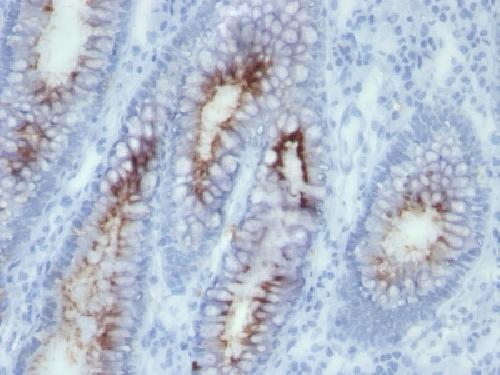 CEACAM5 Antibody