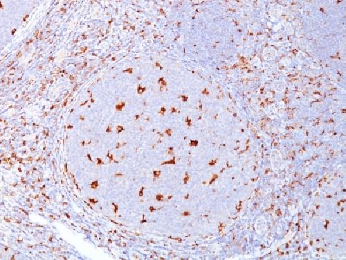 CD68 (Macrophage Marker) Antibody