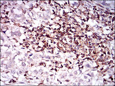 CD68 Antibody