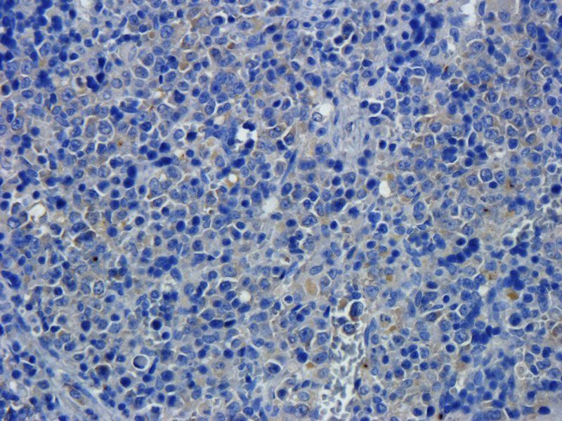 CD68 antibody