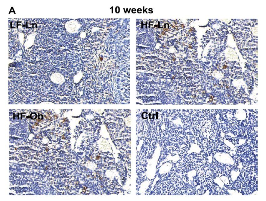 CD68 antibody